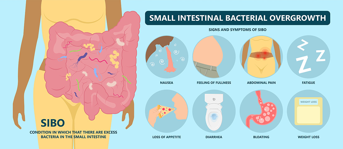 SIBO Symptoms - Small Intestinal Bacterial Overgrowth